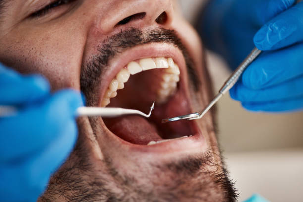 Best Knocked-Out Tooth (Avulsed Tooth) Treatment in Muskegon Heights, MI