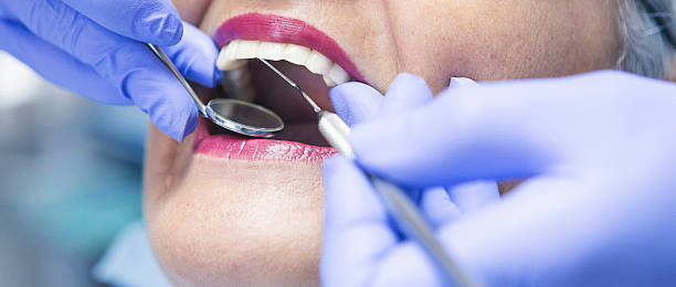 Best Emergency Root Canal Therapy in Muskegon Heights, MI